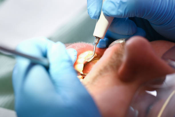 Best Emergency Gum Pain Relief  in Lexington, OH