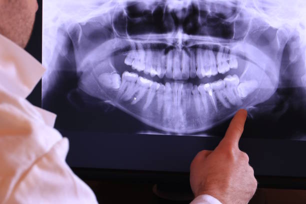 Best Emergency Tooth Extraction  in Lexington, OH