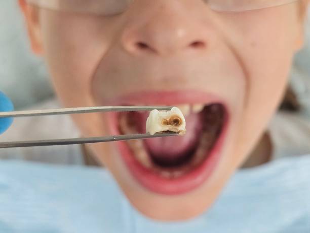 Best Urgent Tooth Repair  in Lexington, OH