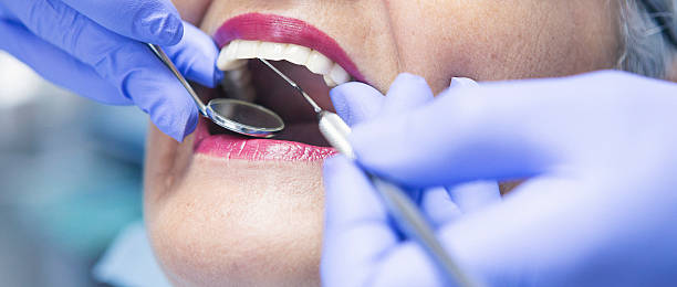 Best Root Canal Emergency Dentist  in Lexington, OH