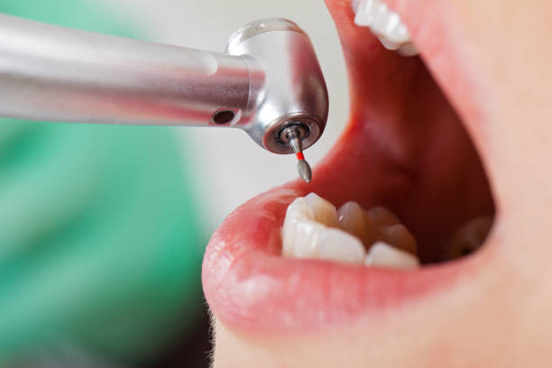 Best Emergency Pediatric Dentist  in Lexington, OH